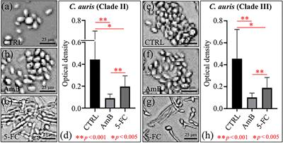 Raman Study of Pathogenic Candida auris: Imaging Metabolic Machineries in Reaction to Antifungal Drugs